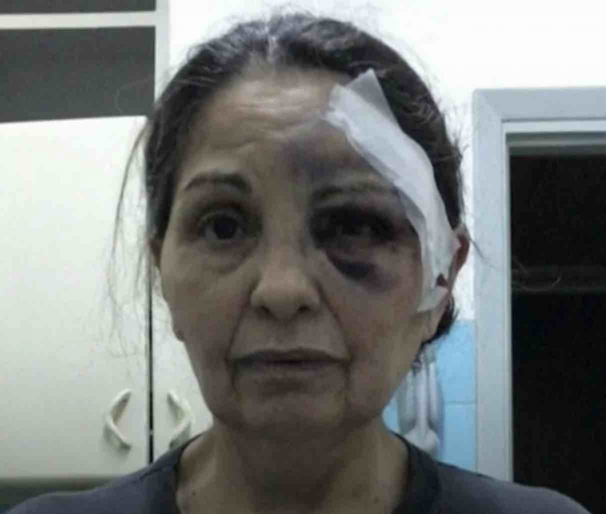Rosa, mujer atacada en un consultorio de La Paternal
