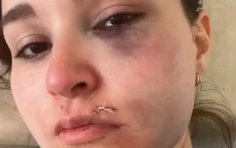 Captura por violencia doméstica en San Francisco Solano después de agresión a…