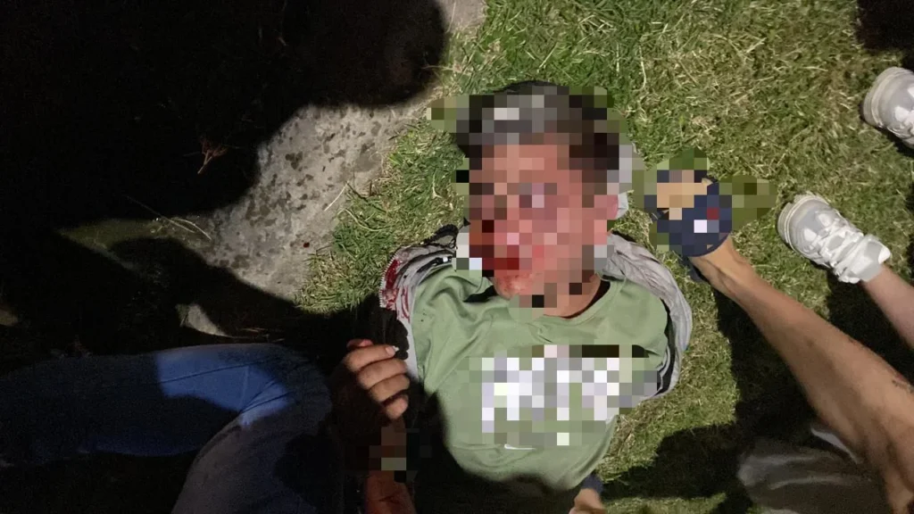 Hirió de bala para robar en Morón: terminó golpeado y reducido por los vecinos…