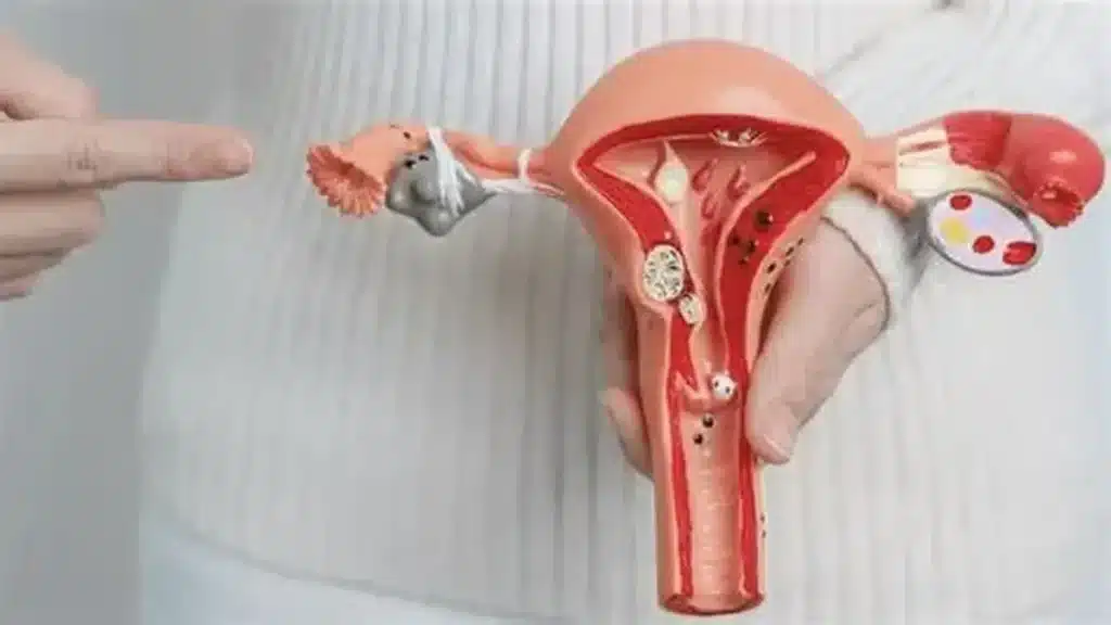 Lomas: jornadas de prevención de cáncer de cuello uterino